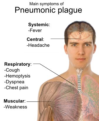 äʹ Pneumonic Plague