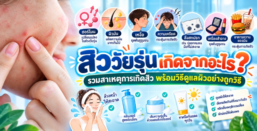 สิววัยรุ่นเกิดจากอะไร? รวมสาเหตุการเกิดสิว พร้อมวิธีดูแลผิวอย่างถูกวิธี