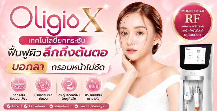 Oligio X ෤�����¡��ЪѺ��鹿ټ���֡�֧�鹵� �͡�ҡ�ͺ˹�����Ѵ