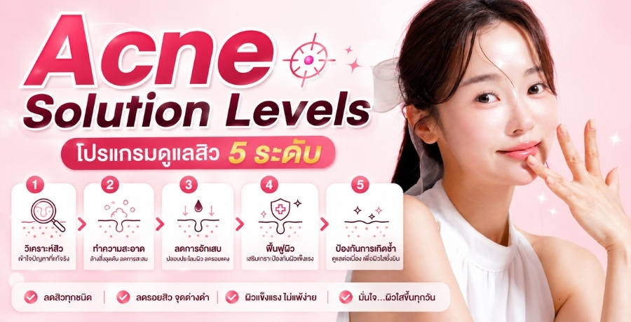 Acne Solution Levels โปรแกรมดูแลสิว 5 ระดับ Acne Solution Levels โปรแกรมดูแลสิว 5 ระดับ