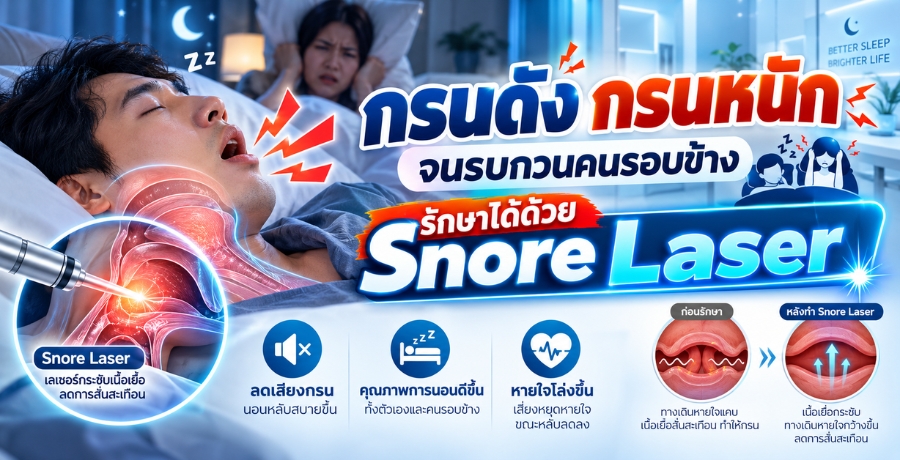 กรนดัง กรนหนักจนรบกวนคนรอบข้าง รักษาได้ด้วย Snore Laser