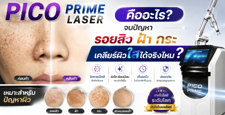 Pico Prime Laser คืออะไร? จบปัญหารอยสิว ฝ้า กระ เคลียร์ผิวใสได้จริงไหม