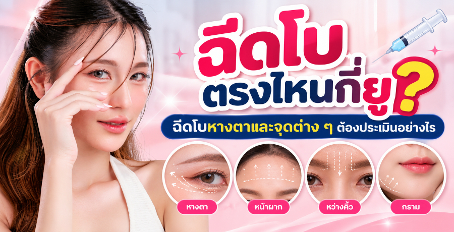 ฉีดโบตรงไหนกี่ยู? ฉีดโบหางตาและจุดต่าง ๆ ต้องประเมินอย่างไร