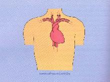 การผ่าตัดเปลี่ยนหัวใจ การผ่าตัดเปลี่ยนหัวใจ