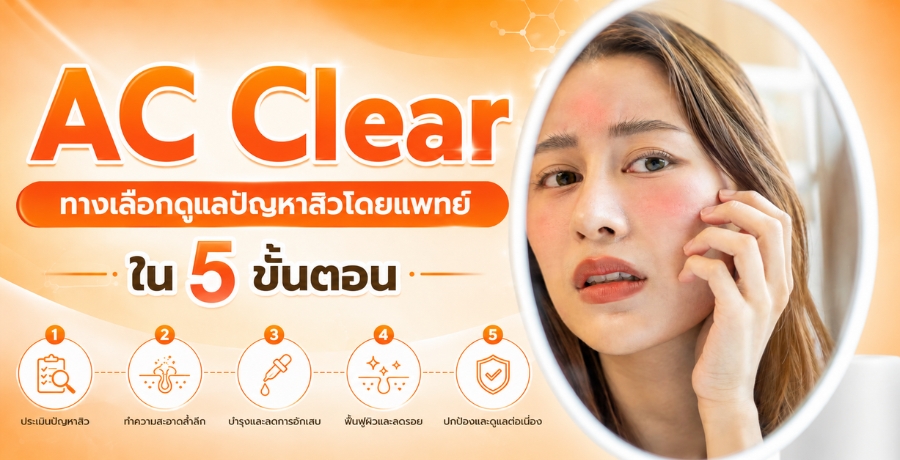 AC Clear ทางเลือกดูแลปัญหาสิวโดยแพทย์ใน 5 ขั้นตอน