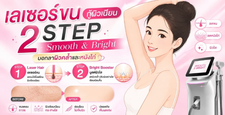 เลเซอร์ขนกู้ผิวเนียน 2 Step Smooth & Bright บอกลาผิวคล้ำและหนังไก่