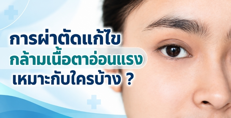 การผ่าตัดแก้ไขกล้ามเนื้อตาอ่อนแรงเหมาะกับใครบ้าง ?