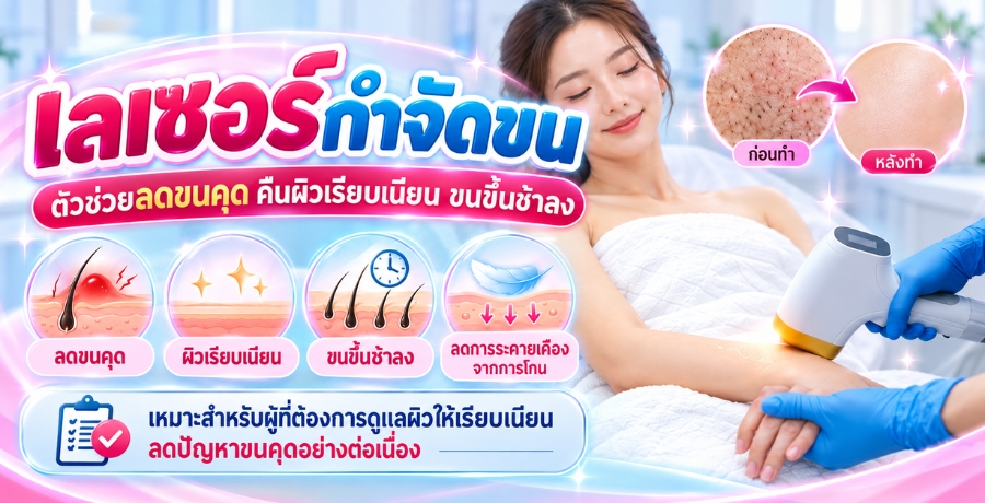 เลเซอร์กำจัดขน ตัวช่วยลดขนคุด คืนผิวเรียบเนียน ขนขึ้นช้าลง